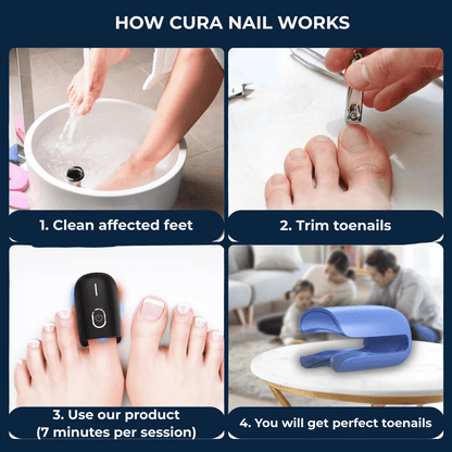 Cura Nail