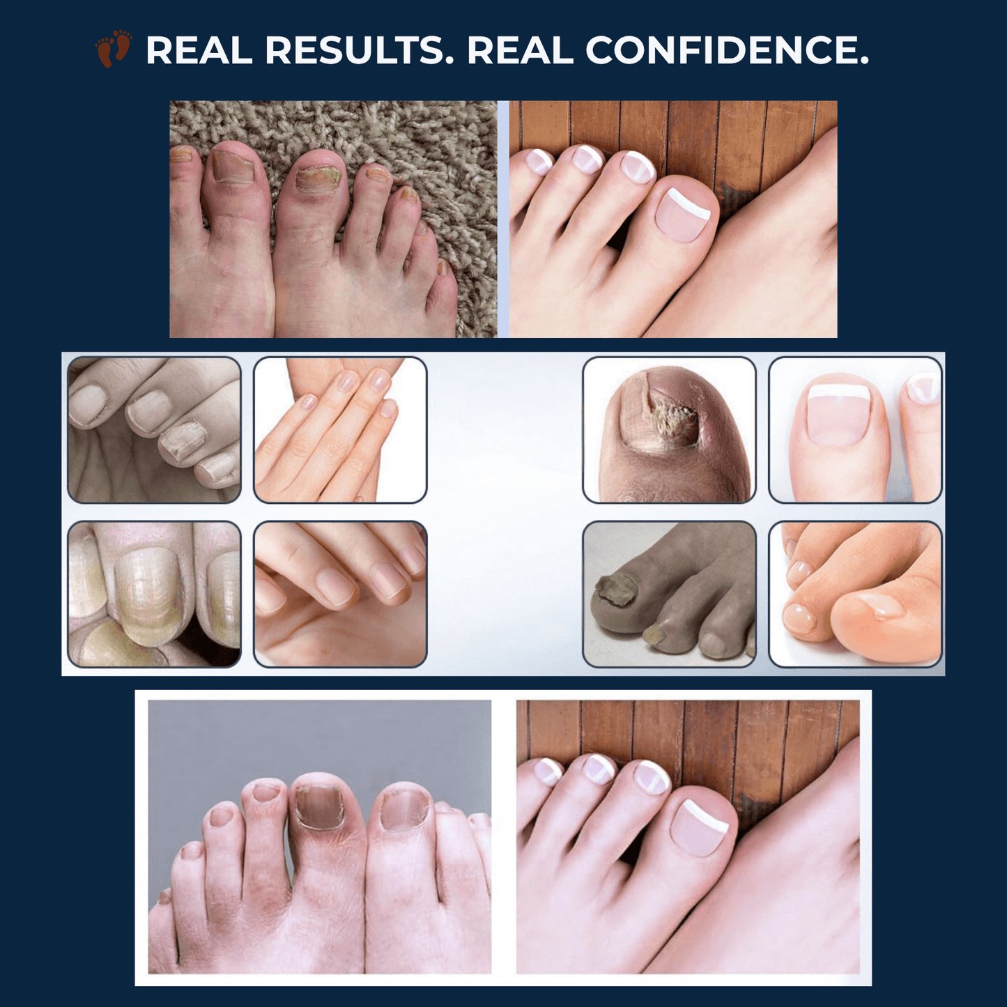 Cura Nail