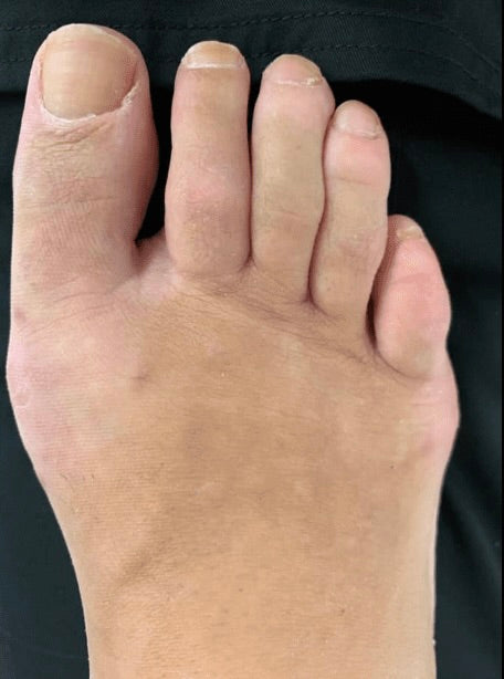 After 4 weeks result 1
