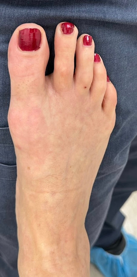 After 4 weeks result 4