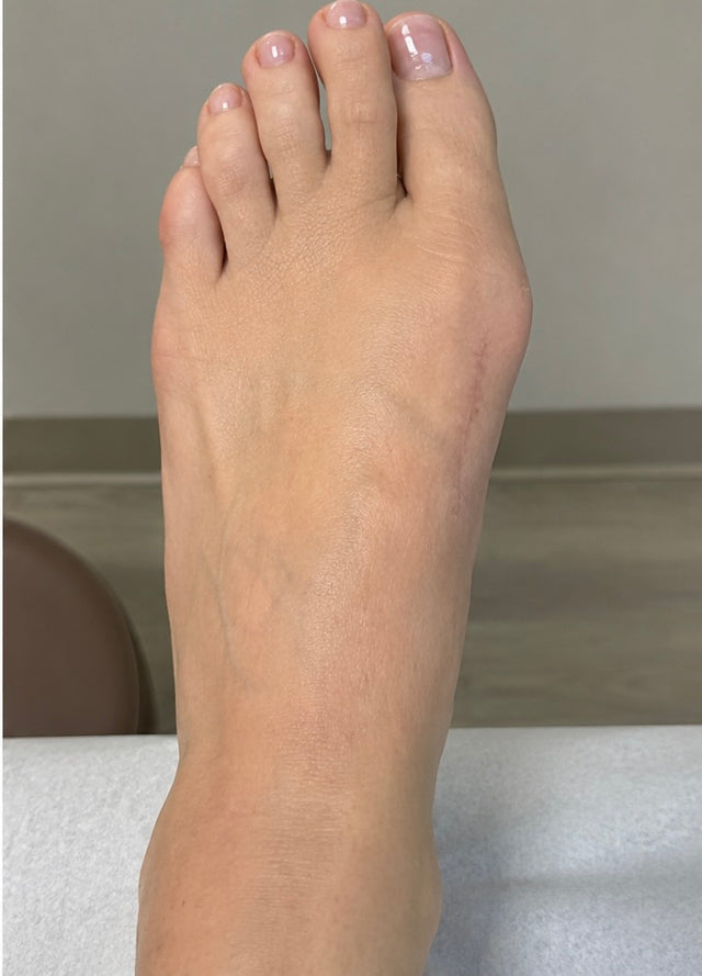 After 3 weeks result 2