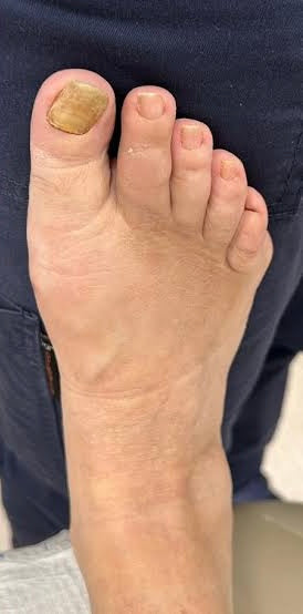 After 3 weeks result 3